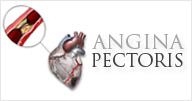 Angina - Vanda Rossen
